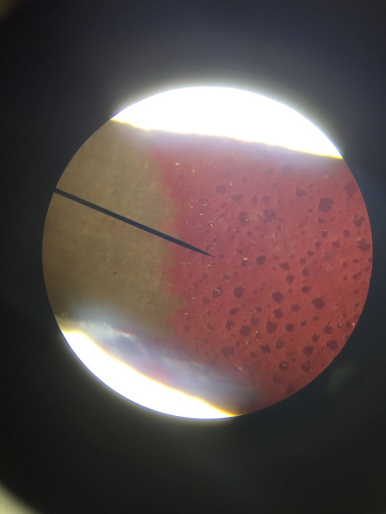 Bukow-mikroskopische-Fotografie