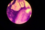 Gefärbte Nervenzelle unter dem Mikroskop